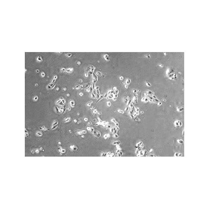 Recombinant Human Clusterin Protein