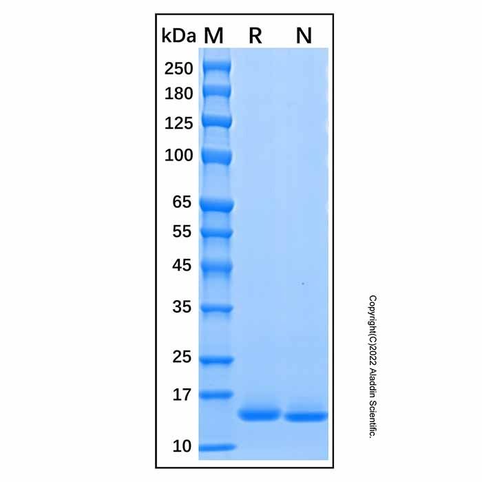 Recombinant Human Cystatin D Protein