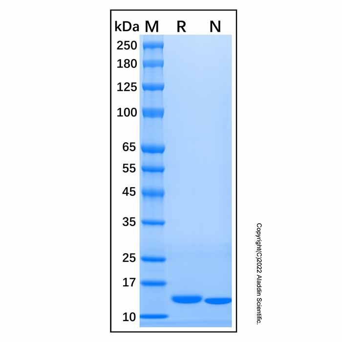 Recombinant Human Cystatin S Protein
