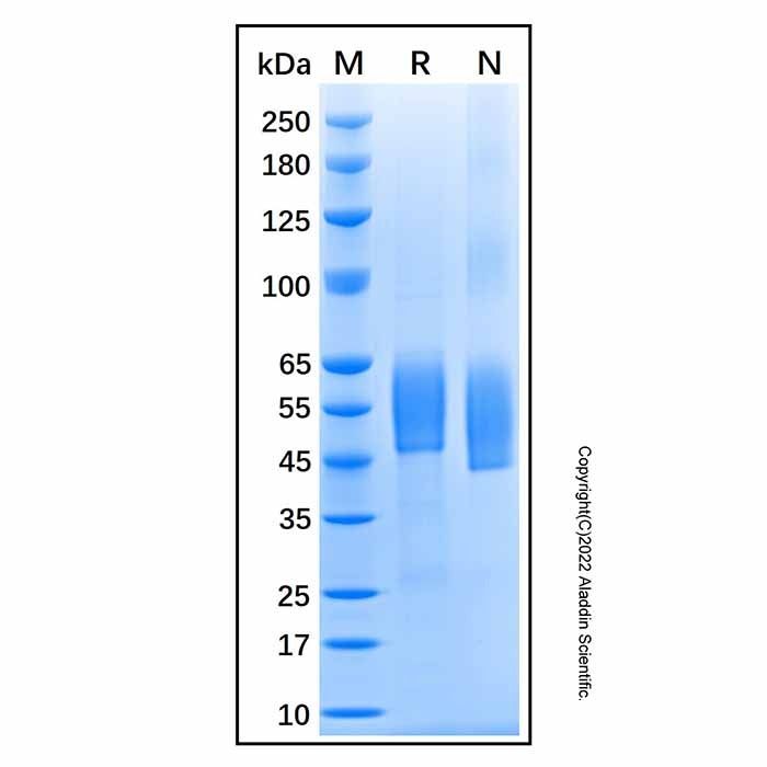 Recombinant Human DKK3 Protein