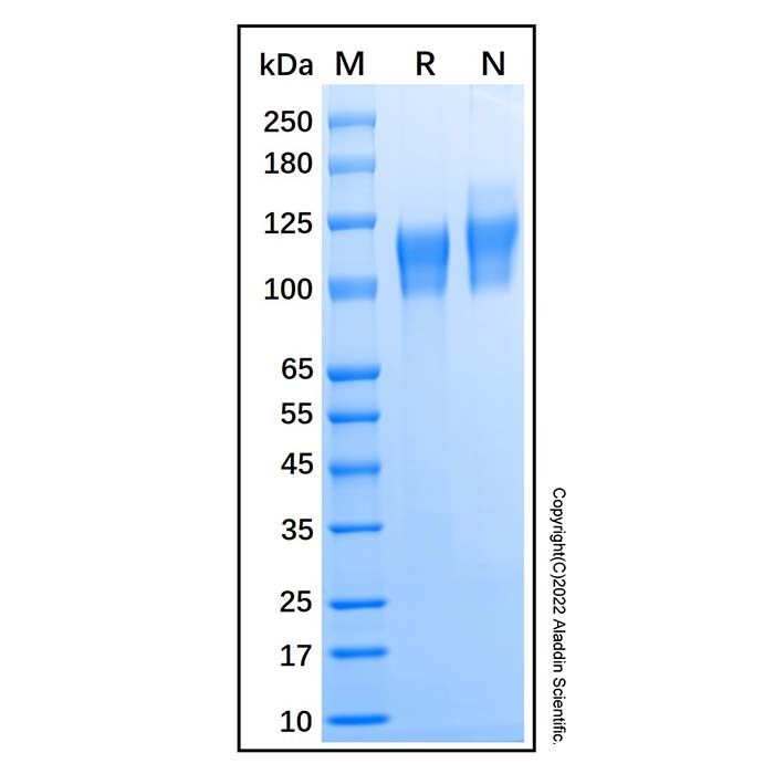 Recombinant Human ECE-1 Protein