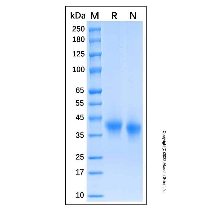 Recombinant Human Ephrin-A3 Protein