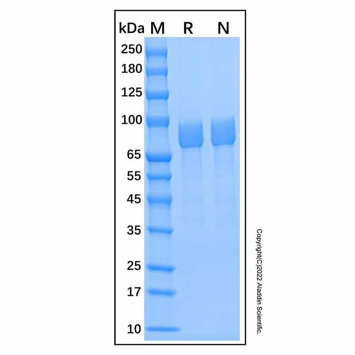Recombinant Human Iduronate 2-Sulfatase Protein
