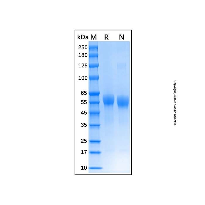 Recombinant Human IL-3RB Protein