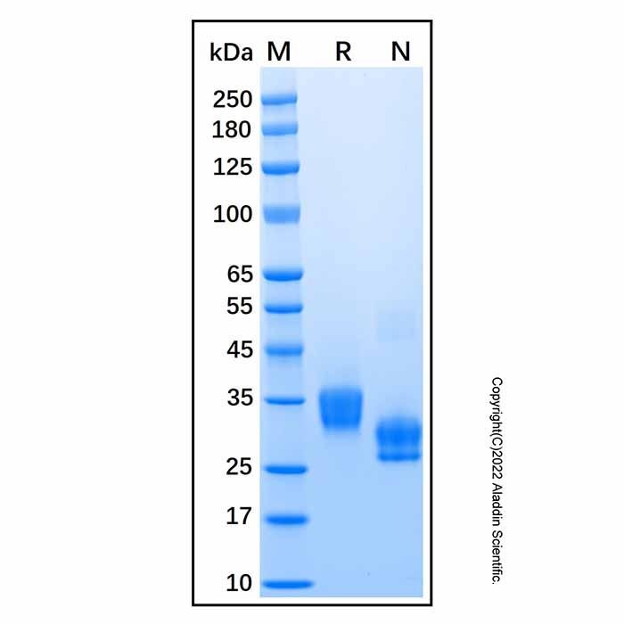 Recombinant Human Kallikrein 8/Neuropsin Protein