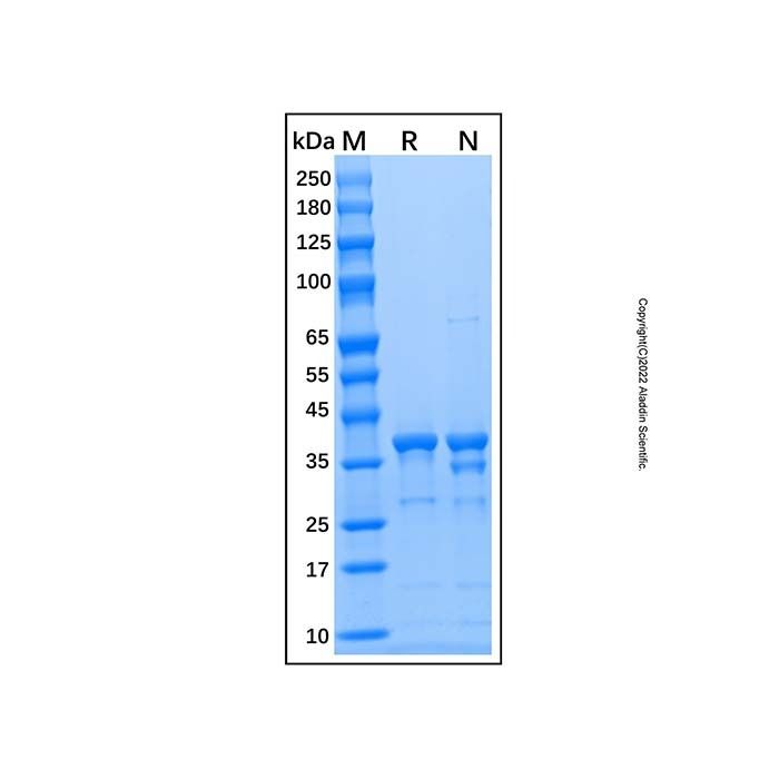 Recombinant Human Arginase 1/ARG1 Protein