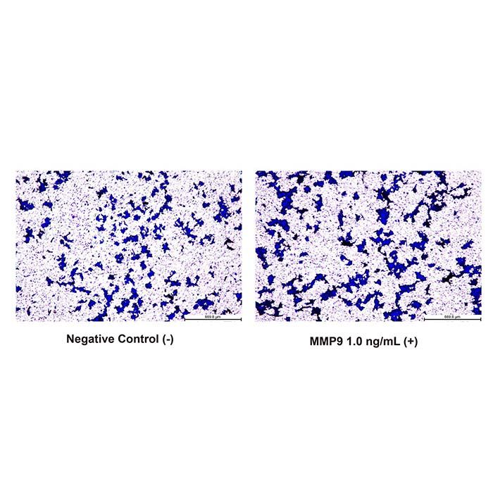 Recombinant Human MMP9 Protein