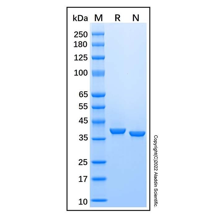 Recombinant Human Pepsinogen C/PGC Protein