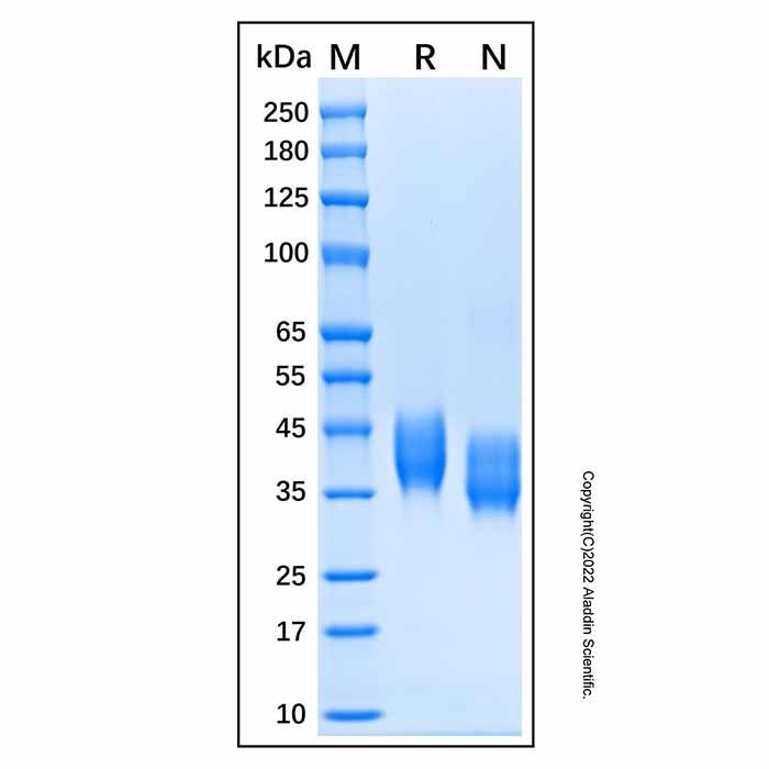 Recombinant Human TEM8/ANTXR1 Protein