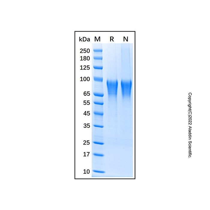 Recombinant Human TIM-4 Protein