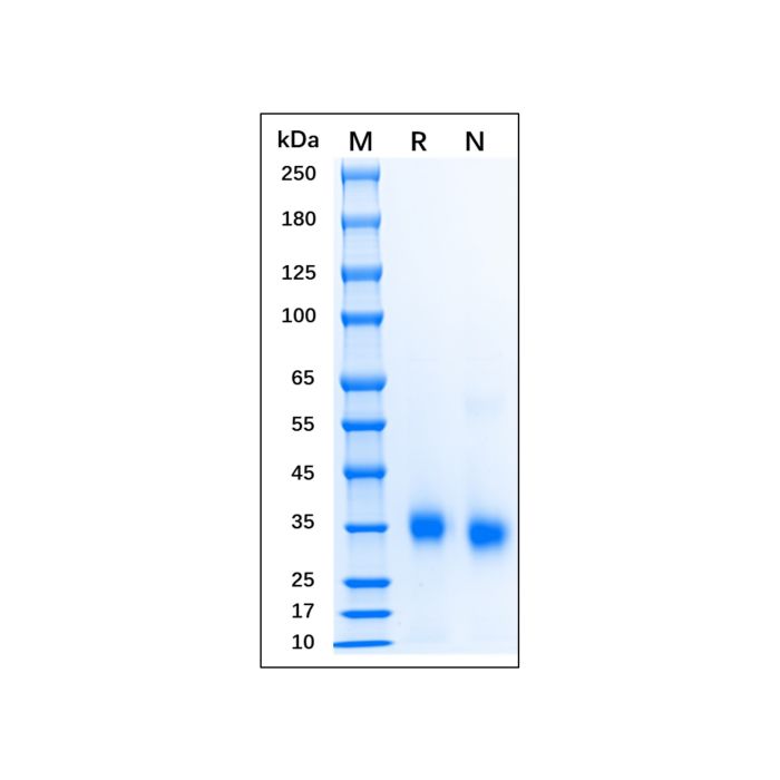 Recombinant Human SARS-CoV-2 Spike Protein RBD