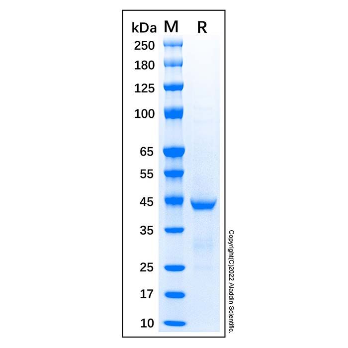 Recombinant Human ACTA2 Protein