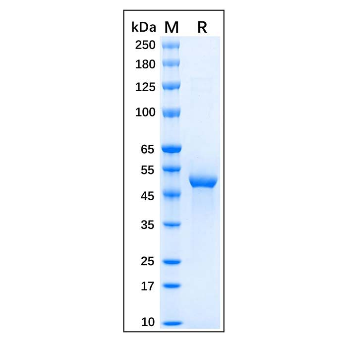 Recombinant Human GFAP Protein