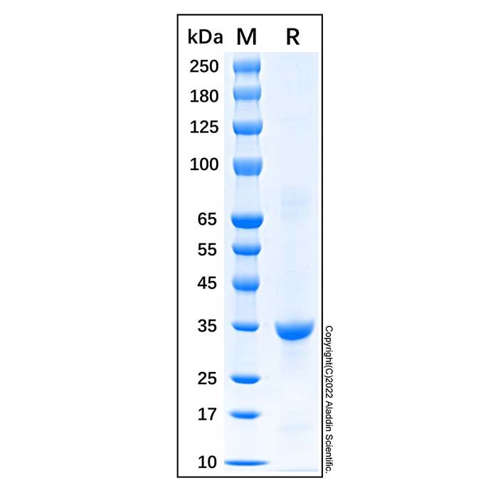 Recombinant Human Cyclin D1 Protein