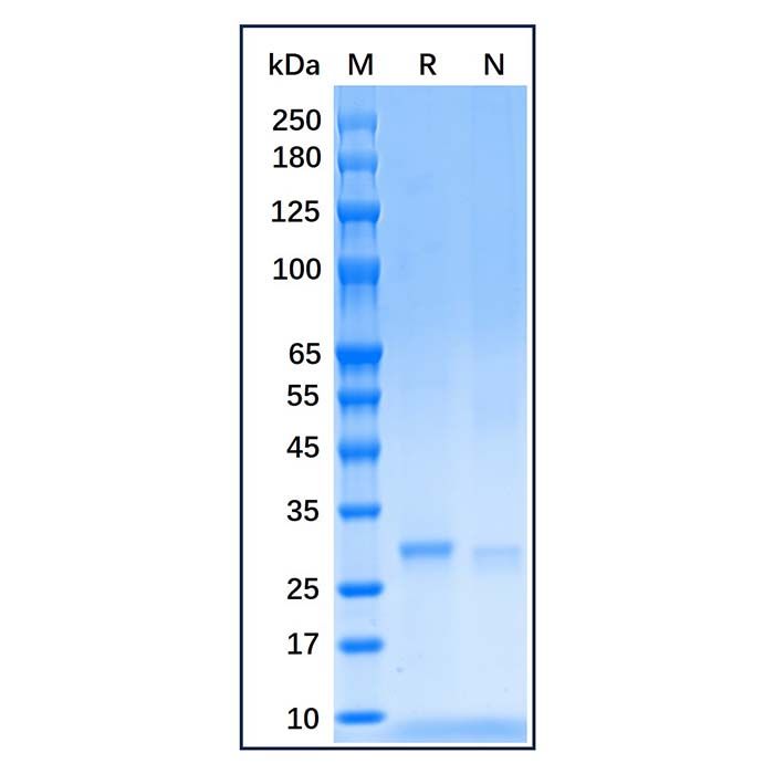 Recombinant Human SDHB Protein
