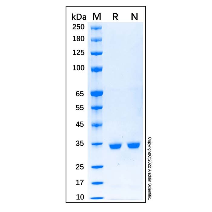 Recombinant Human Calponin 1 Protein