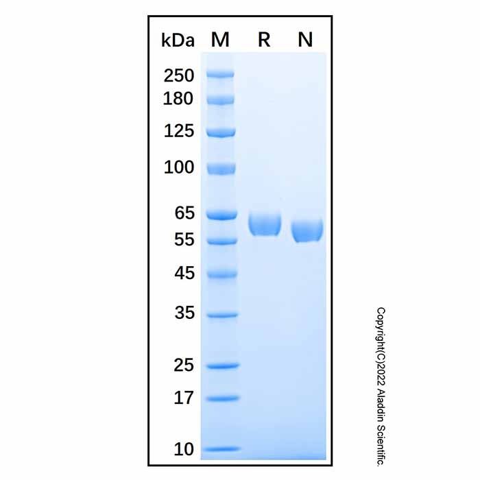 Recombinant Human DPPII/QPP/DPP7 Protein