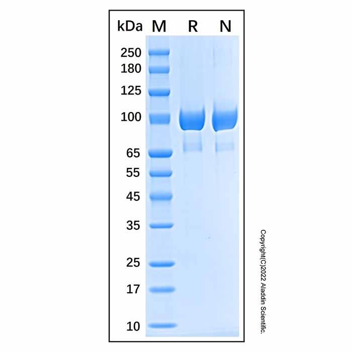 Recombinant Human Complement Component C2 Protein