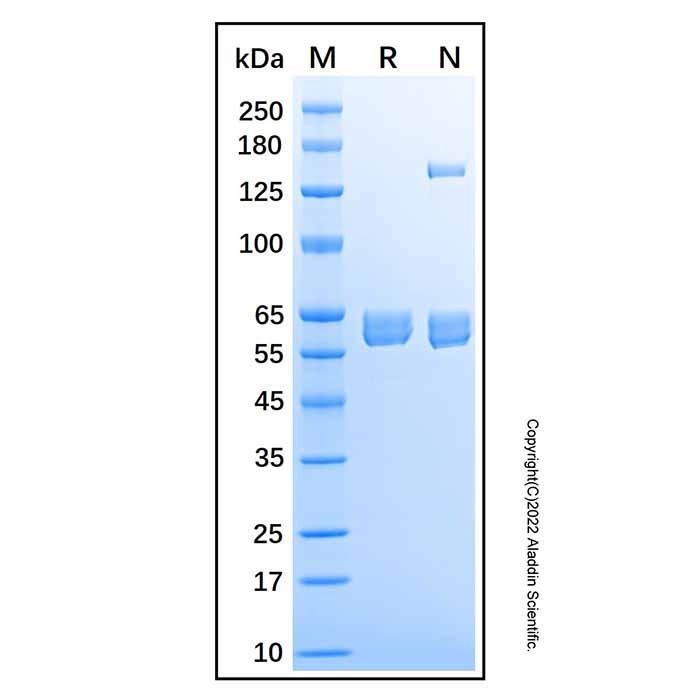 Recombinant Human Carboxylesterase 2/CES2 Protein