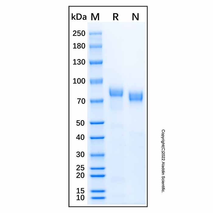 Recombinant Human Plasma Kallikrein/KLKB1 Protein