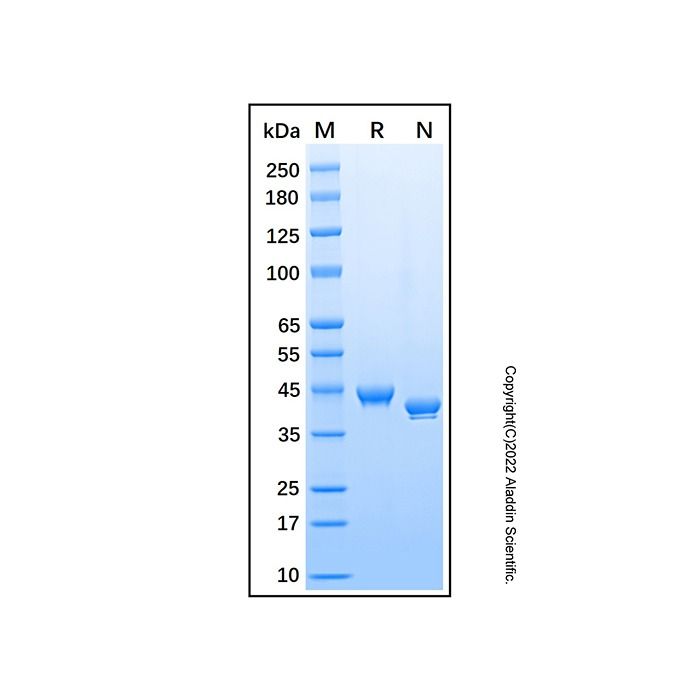 Recombinant Human Notum Protein