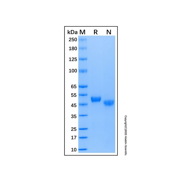 Recombinant Human RAGE Protein