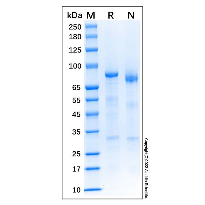 Recombinant Human Complement C1s Protein