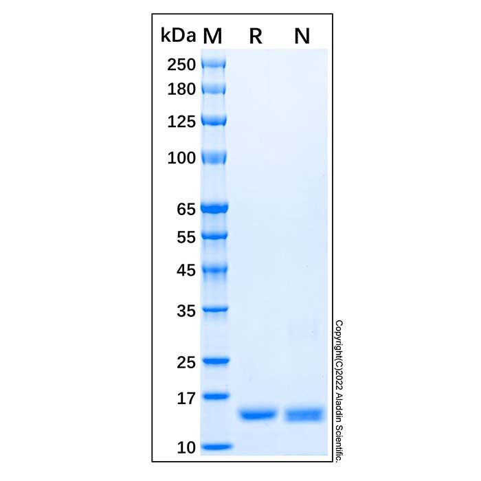 Recombinant Human IL-36Ra/IL-1F5 Protein