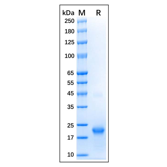 Recombinant Human GTPase HRAS Protein