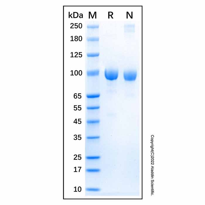 Recombinant Human FAP Protein