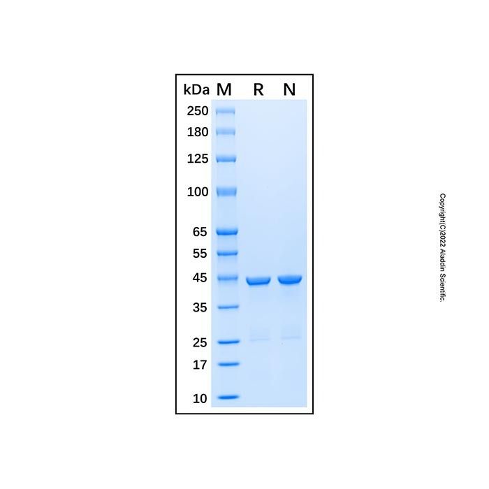 Recombinant Human Cytokeratin 19 Protein