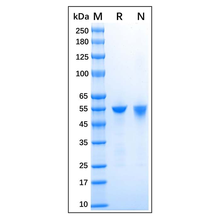 Recombinant Human ALDH1A1 Protein