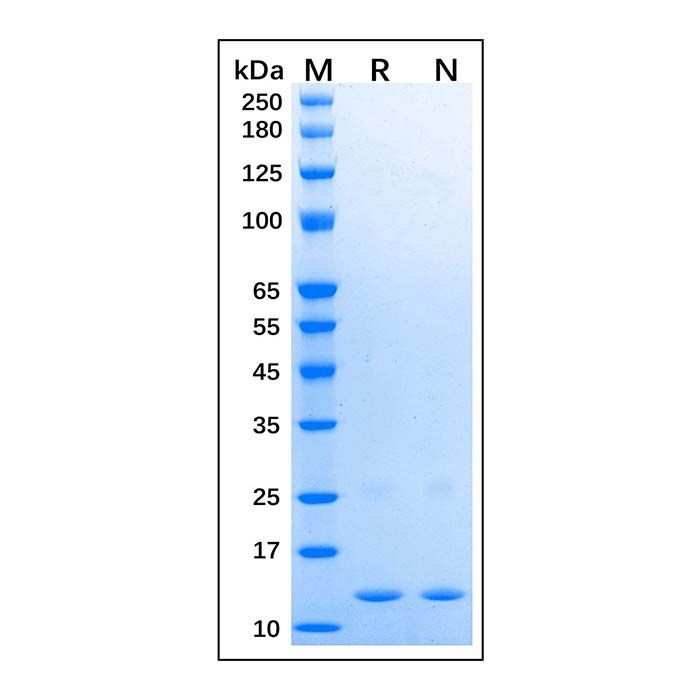 Recombinant Human SAA1 Protein