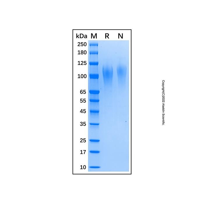 Recombinant Human TIM-1/KIM-1/HAVCR Protein