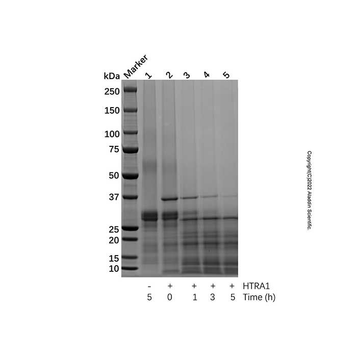 Recombinant Human HTRA1 Protein