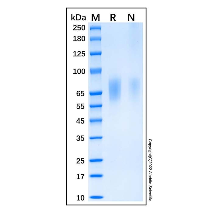 Recombinant Human Guanylyl Cyclase C/GUCY2C Protein