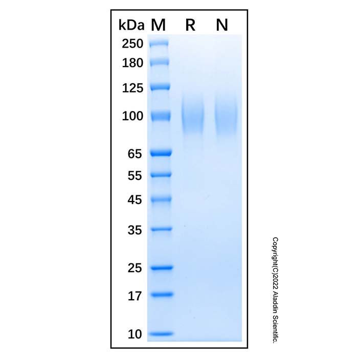 Recombinant Human gp130 Protein
