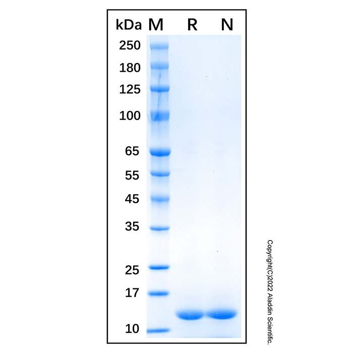 Recombinant Human FABP1/L-FABP Protein