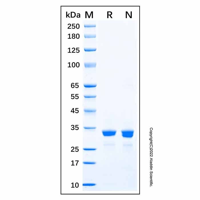 Recombinant Human SULT1B1 Protein