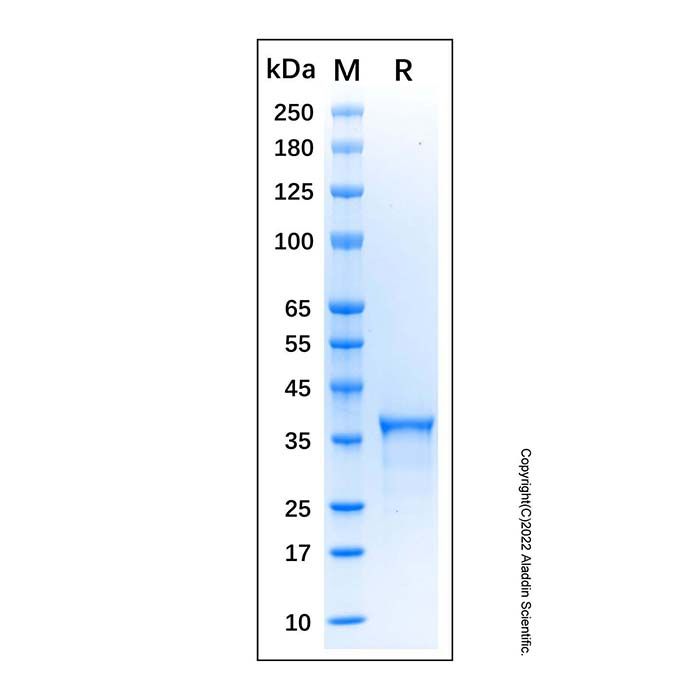 Recombinant Human Estrogen Receptor beta Protein