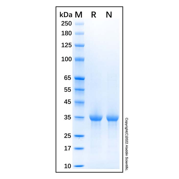 Recombinant Human PARP-1 Protein
