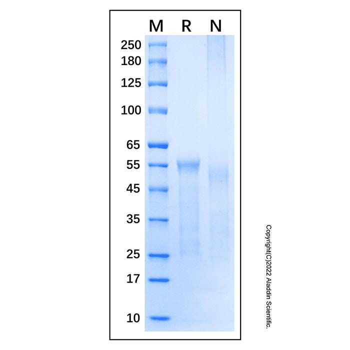 Recombinant Human XIAP Protein