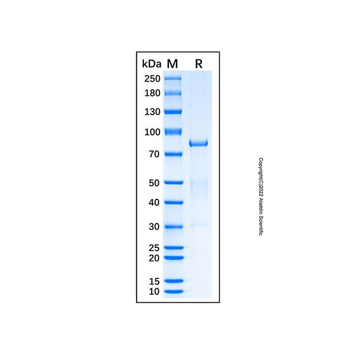 Recombinant Human SDHA Protein