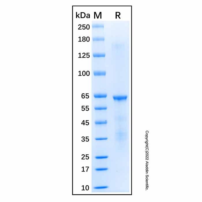 Recombinant Human Chk2 Protein