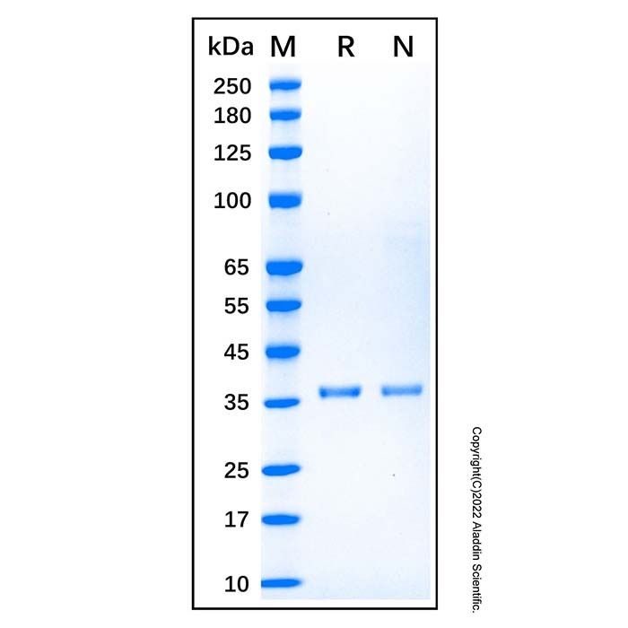 Recombinant Human Cytokeratin 5 Protein