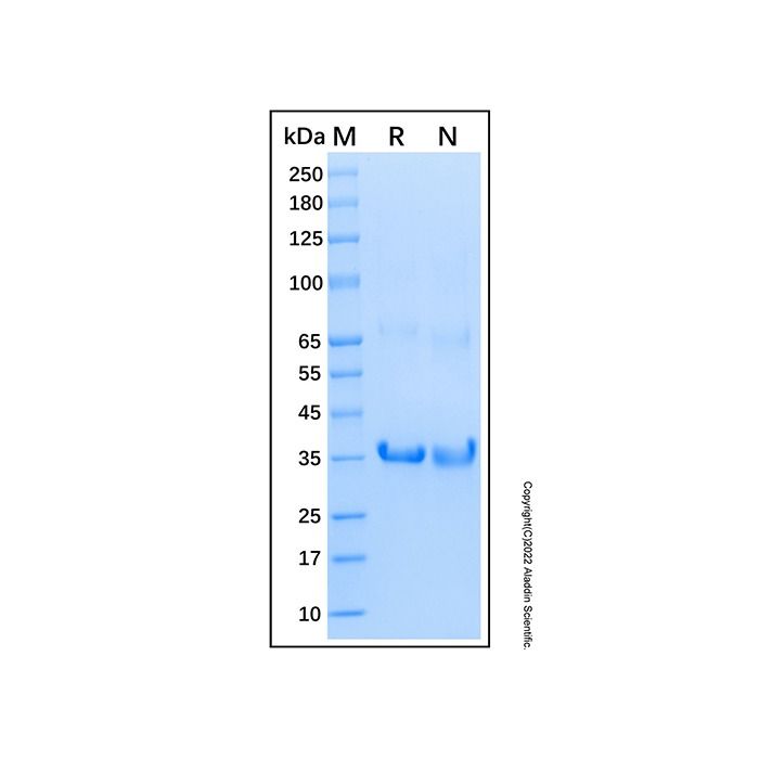 Recombinant Human FOXM1 Protein