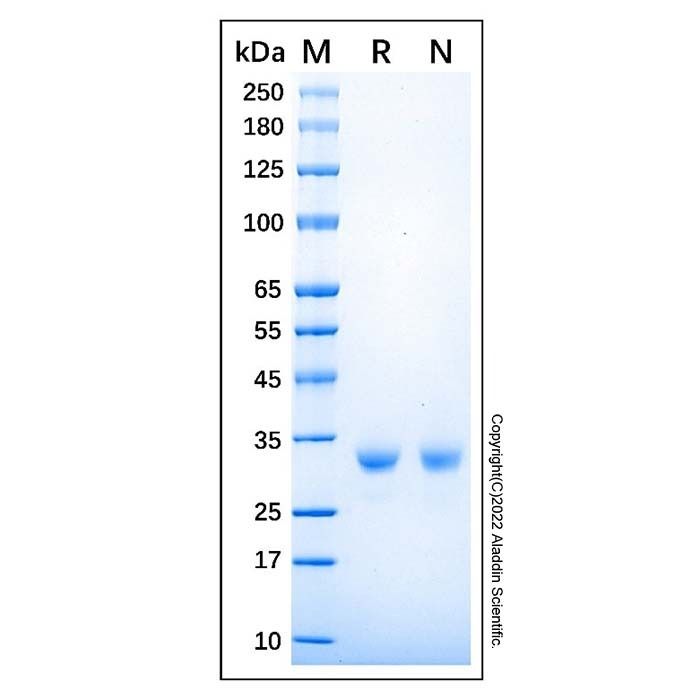 Recombinant Human Histamine N-Methyltransferase/HNMT Protein