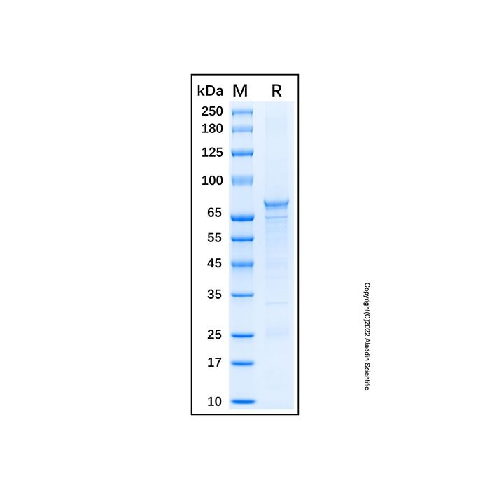 Recombinant Human Sirtuin 1/SIRT1 Protein