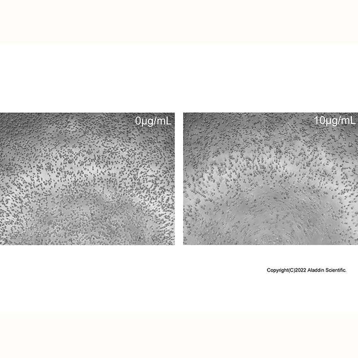 Recombinant Human NCAM-1/CD56 Protein