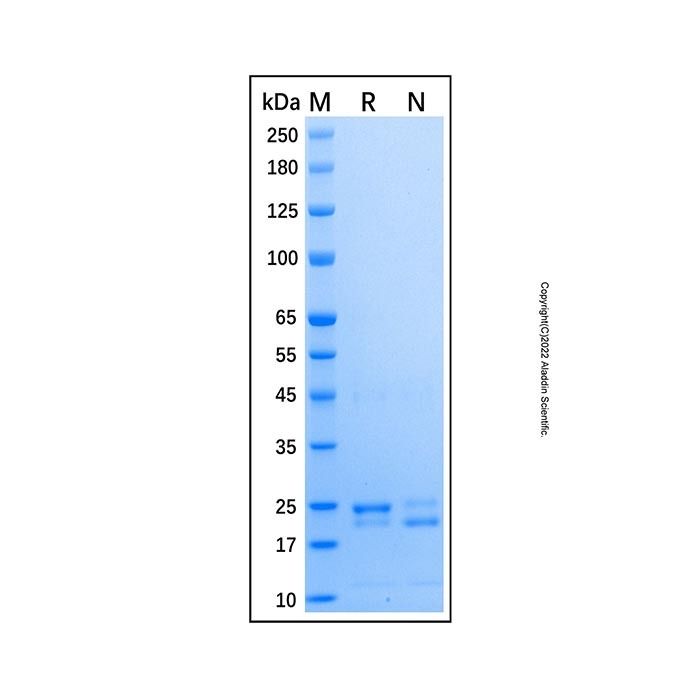 Recombinant Human Cytoglobin Protein